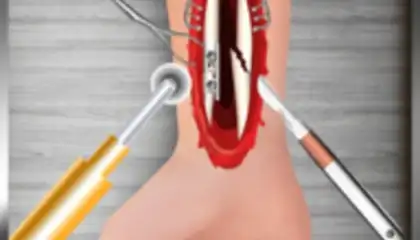 WristSurgeryDoctor